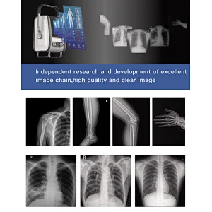 Portable X Ray Gold Testing Analyzer Cr xrays System Ray X Price Printer Generator Markers Insert Radiology X-ray Equipment