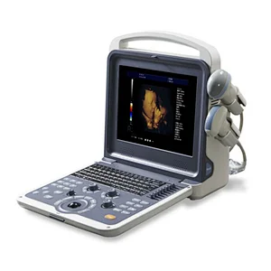 MY-A035A medical 12 inch LCD full digital color doppler ultrasound scanner portable