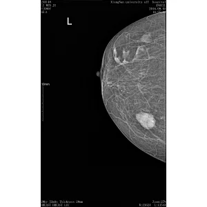 Digital breast 3d mammography machine 3-d ge scanning appareil de mammographie prix led x ray film Mamografia dr system price