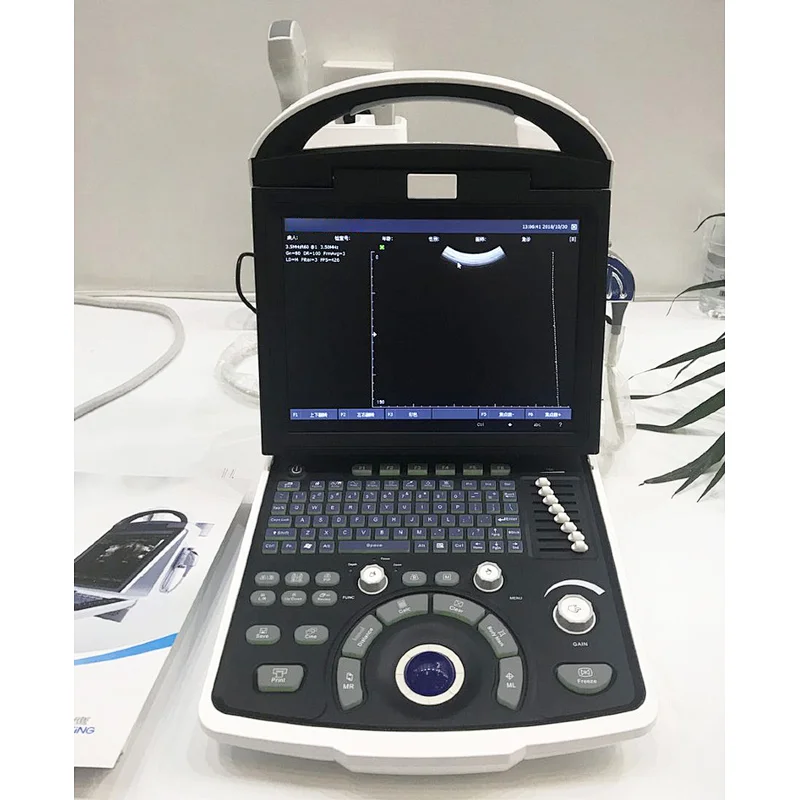 MY-A003B medical supplies full digital laptop ultra sound machine ultrasound scanner