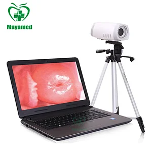 MY-F003 medical gynecology portable mini digital video colposcope for vagina