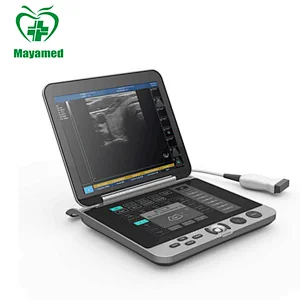 Top Selling Transductor Ecografia 12.1-inch LED All digital Ultrasound System Portable Ultrasound machine with Convex probe