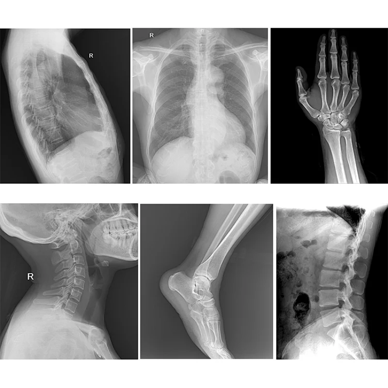 MY-D049J High Frequency Digital X-Ray Radiography System Medical DR X Ray Machine Equipment