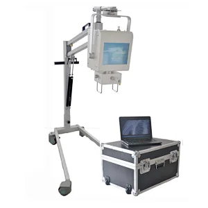 MY-D019D xray medical equipment Portable X-ray Machine