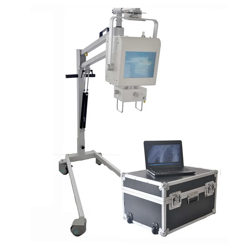 MY-D019D xray medical equipment Portable X-ray Machine
