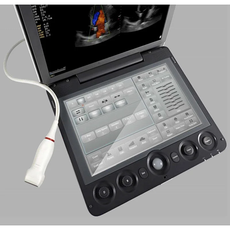 MY-A045 Medical ultrasonic equipment portable color doppler ultrasound scanner for sale