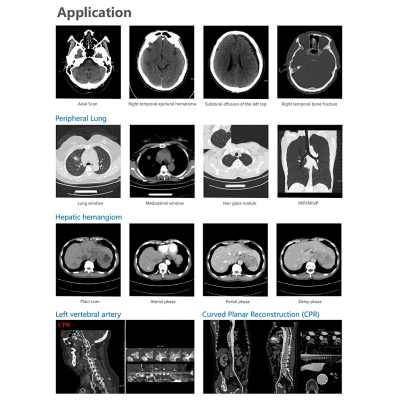 MY-D055C 16 32 64 128 slice computed tomography scanner medical ct scan machine