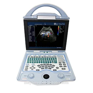 2020 sonoscape new design Trolley type multi-frequency color doppler portable mindray ultrasound scanner from China