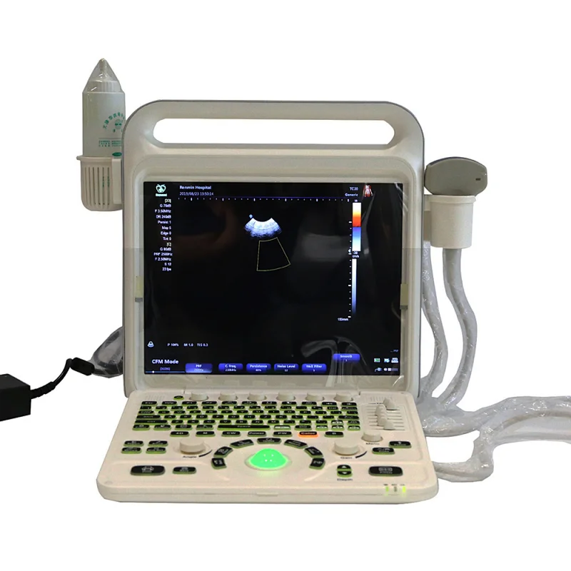 15 inch display portable color doppler ultrasound scanner equipment for gynecology and obstetrics
