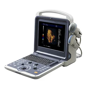 China cheapest medical portable 4d full digital color doppler b ultrasound scanner/scan/machine price for pregnancy with probe