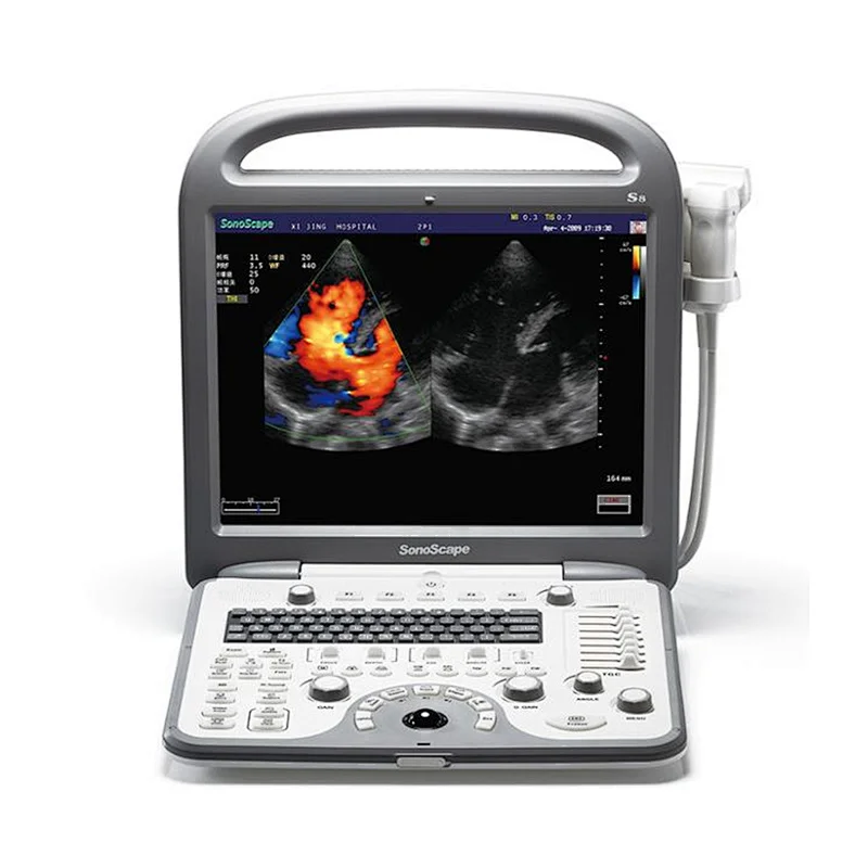 Medical equipment built-in Li-ion battery color doppler ultrasound echocardiography cardiac machine portable