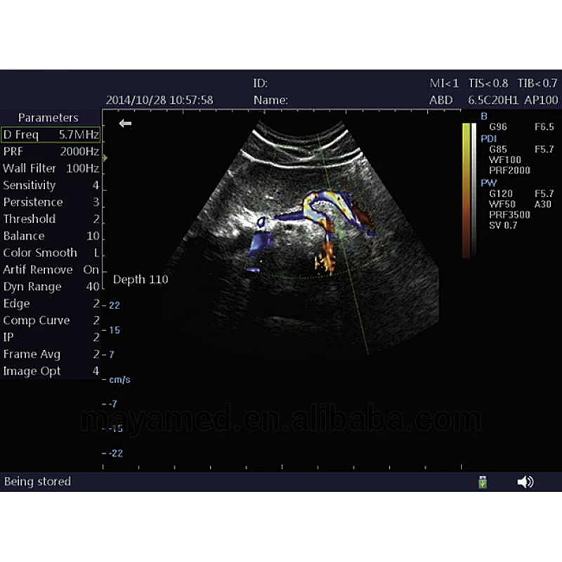 2020 sonoscape new design Trolley type multi-frequency color doppler portable mindray ultrasound scanner from China