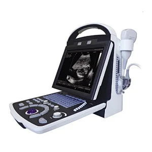 MY-A003B medical supplies full digital laptop ultra sound machine ultrasound scanner