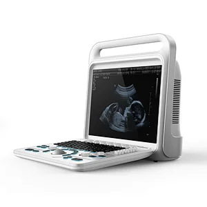 2019 new medical equipment color doppler laptop ultrasound scanner china with probe