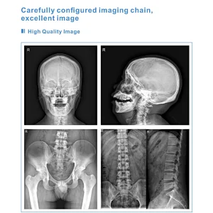 MY-D047B hospital equipment UC-arm medical radiography dr x-ray system x-ray machine