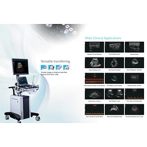 MY-A030F Trolley 19 inch LCD monitor color doppler medical ultrasound instruments