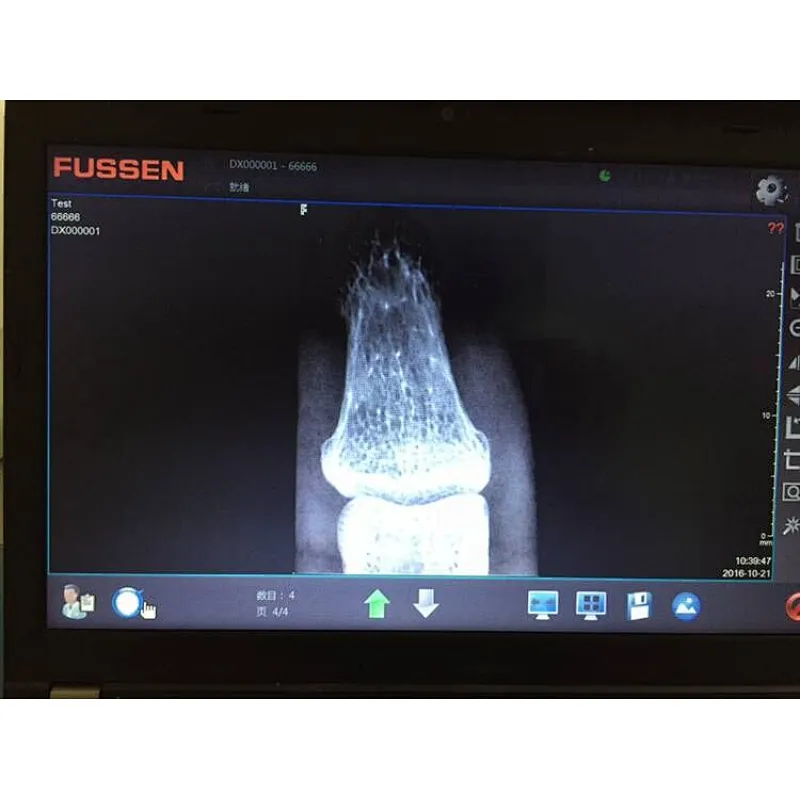 Dental x ray machine film price portable x-ray CE/ISO approved digital camera wireless panoramic scanner developer manufacturer