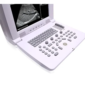 B scan ophthalmic ultrasound mindray low price buy ultrasound machine pricescreen therapy gel pocket probes physical therapy