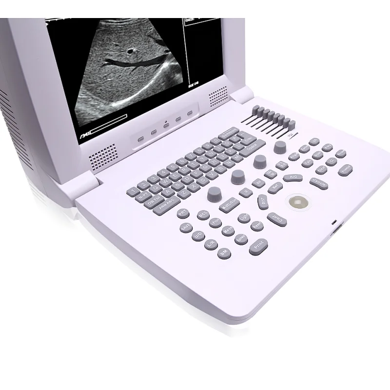 B scan ophthalmic ultrasound mindray low price buy ultrasound machine pricescreen therapy gel pocket probes physical therapy