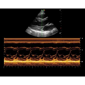 MY-A029 Maya medical product Color Doppler ultrasound scanner with CE approved