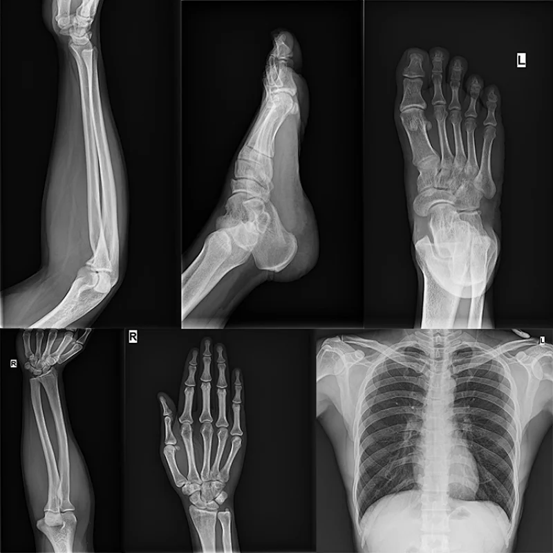 High Frequency MY-D019A Hospital 4KW Digital Portable X-ray System Medical X Ray Machine Equipment Price