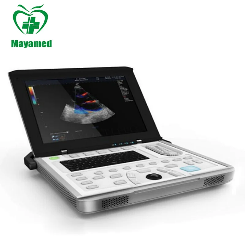 MY-A039A Medical Digital color doppler cardiac ultrasound machine Special use for cardiac examination and cardiac surgery