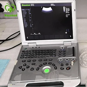 MY-A024B-N Portable advanced imaging technology Laptop CW Color Doppler Ultrasound Scanner
