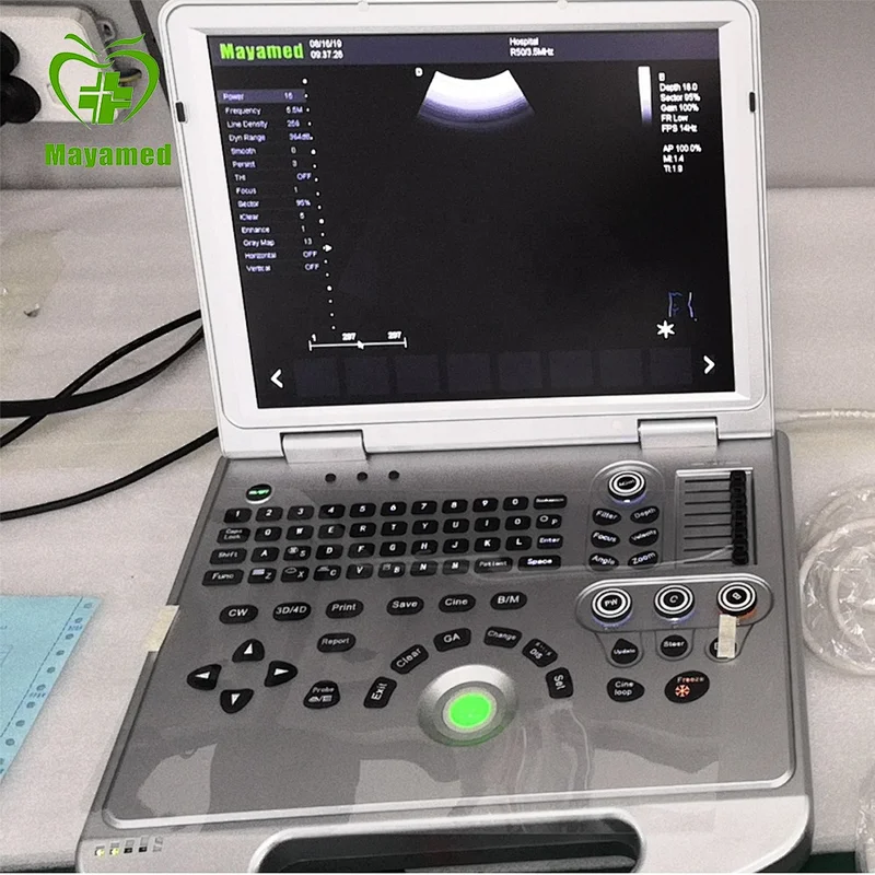 MY-A024B-N Portable advanced imaging technology Laptop CW Color Doppler Ultrasound Scanner