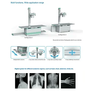 MY-D049A-N High frequency radiography system dual focus digital xray machine medical x-ray