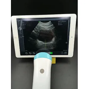 MY-A010B-N Electronic array medical portable handheld ultrasound wireless convex probe