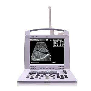 B scan ophthalmic ultrasound mindray low price buy ultrasound machine pricescreen therapy gel pocket probes physical therapy