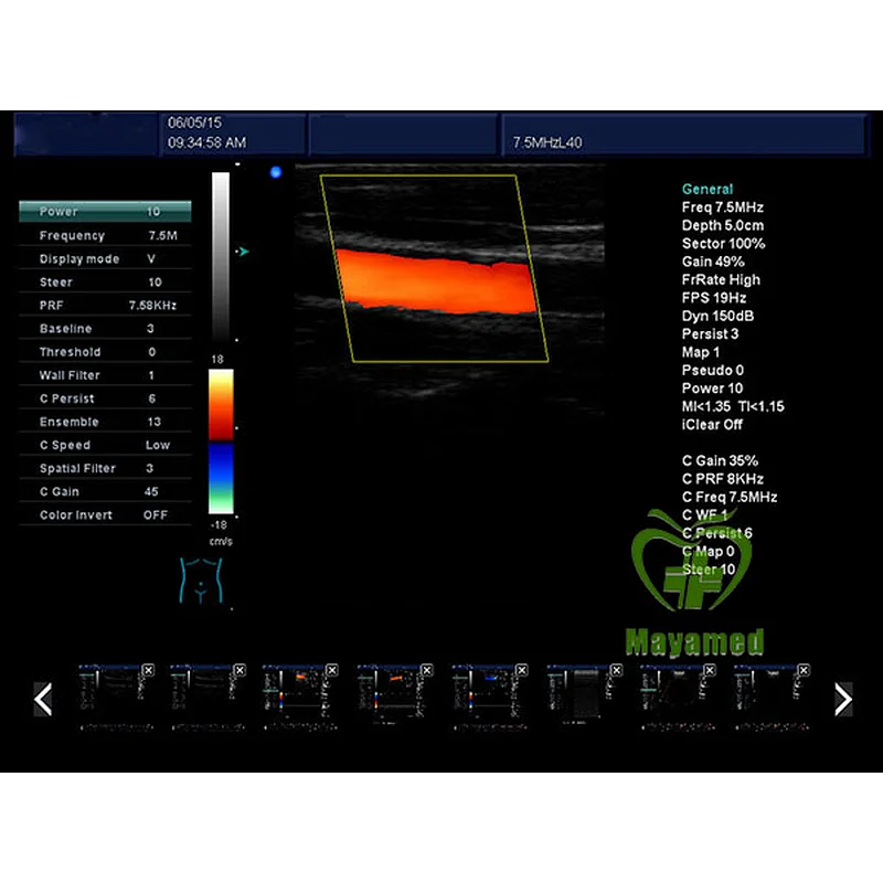 MY-A035A medical 12 inch LCD full digital color doppler ultrasound scanner portable