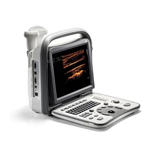 128 elements portable ultrasound scanner,medical ultrasound instruments