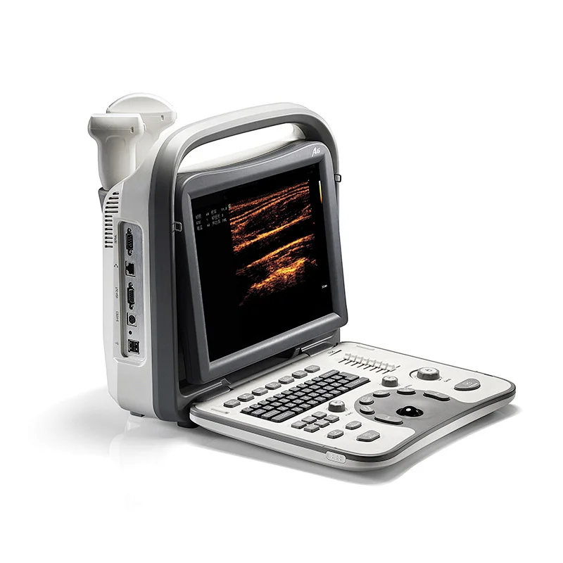 128 elements portable ultrasound scanner,medical ultrasound instruments