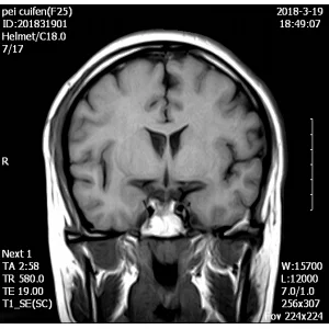 MY-D054 Hospital Medical 0.5T MRI scanner/scan/machine equipment price for sale