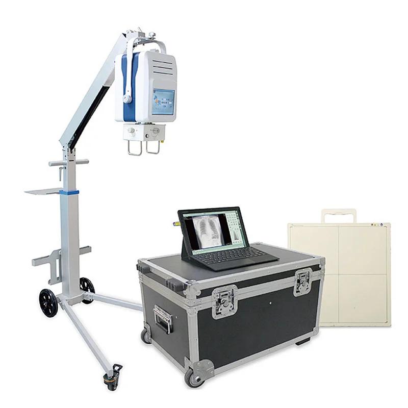 MY-D049R digital portable mobile radiography x- ray system medical x ray machine