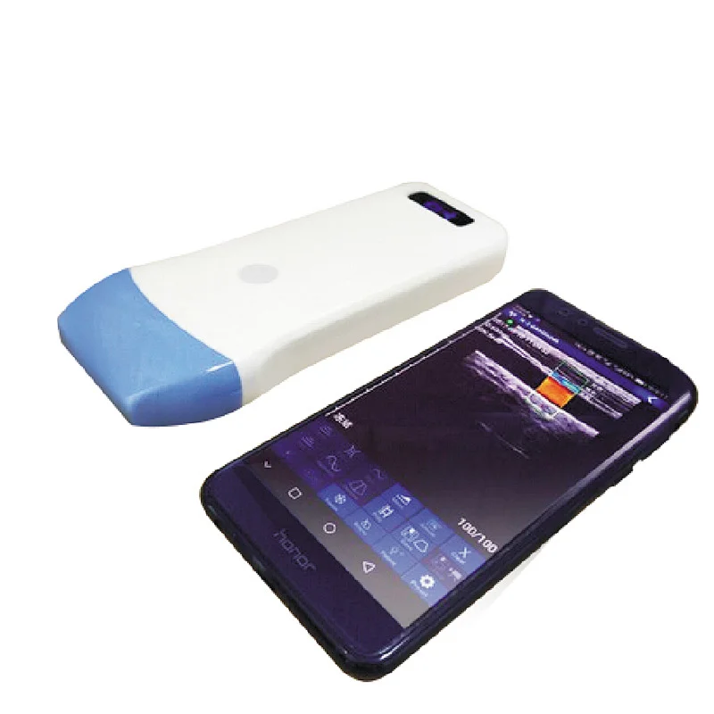 MY-A023D linear ultrasound probe wireless color doppler handheld portable ultrasound scanner