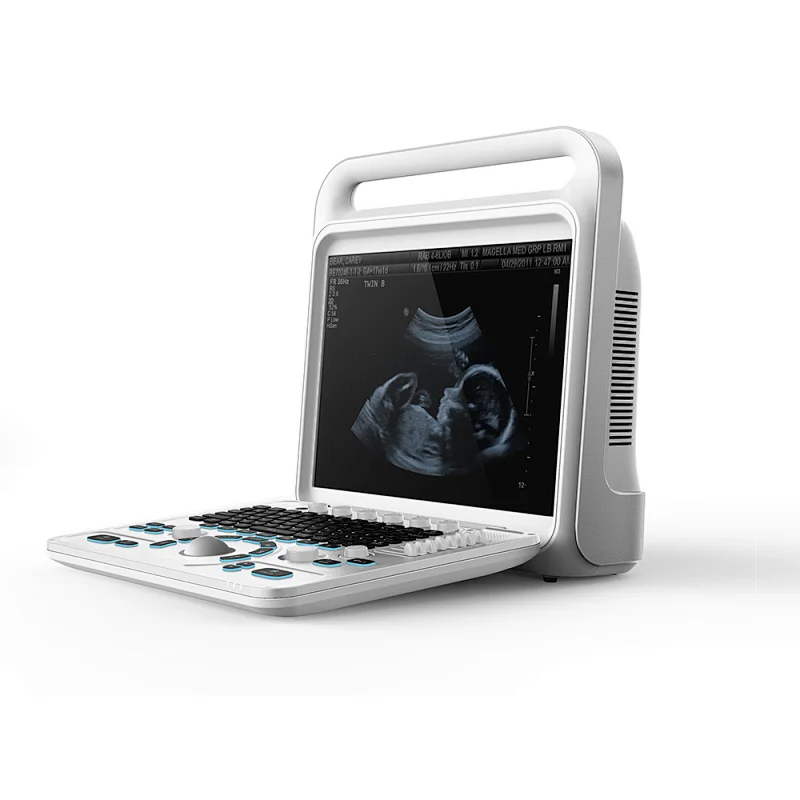 Buy medical Cavitation ultrasound trolly machines price ultrasound machine echography wireless Color Doppler Ultrasound Scanner