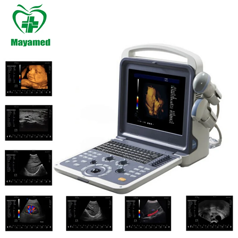 Multiparametro veterinarios medical sonoscape portable Full Digital monitor Color Doppler Ultrasound machine/scanner with  Probe
