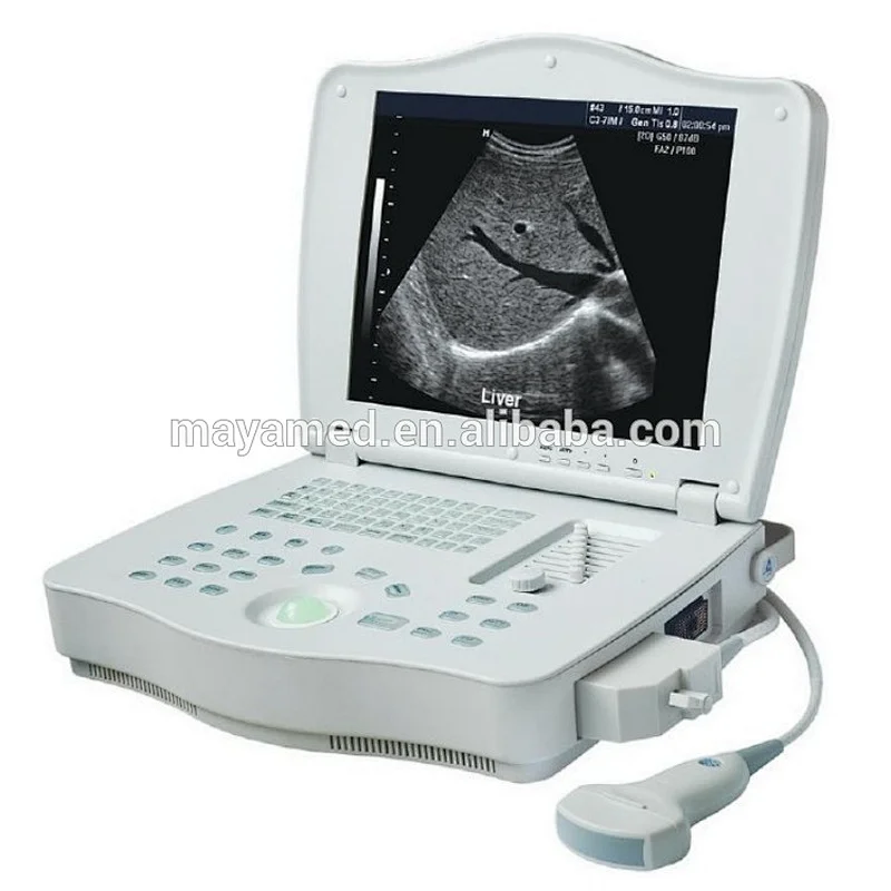 MY-A004 cheap price medical doppler ultra sound portable ultrasound machine handheld LCD scanner with Multi-frequency probes