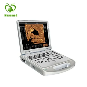 MY-A024B-N Portable advanced imaging technology Laptop CW Color Doppler Ultrasound Scanner