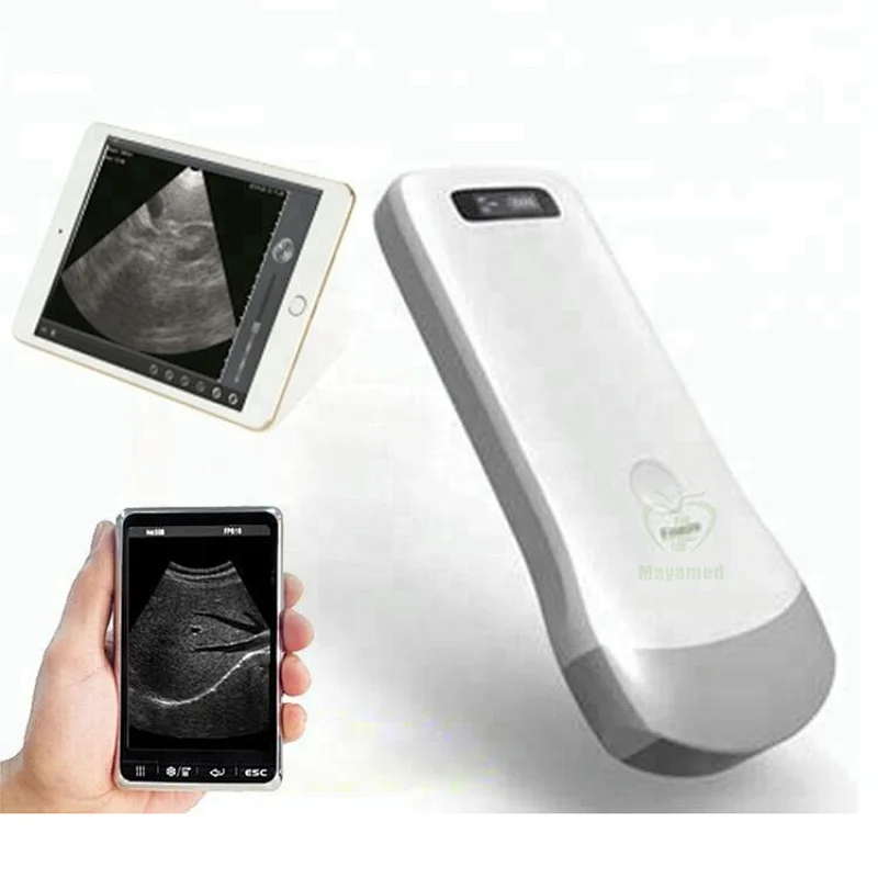 High quality MY-A010B portable type handheld wireless ultrasound convex probe price for smartphone/iphone/ipad