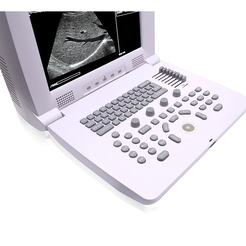 Portable mindray ultrasound obstetric MY-A002A hospital All-Digital Ultrasound Diagnosing Equipment