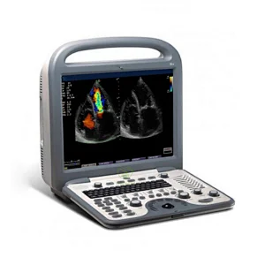 Medical equipment built-in Li-ion battery color doppler ultrasound echocardiography cardiac machine portable