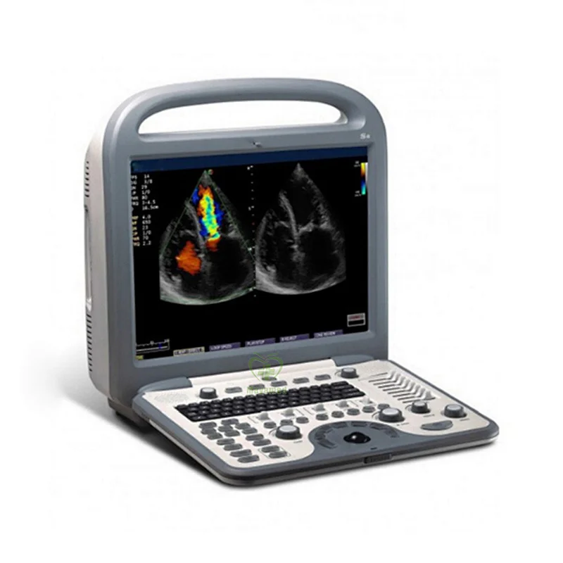 Medical equipment built-in Li-ion battery color doppler ultrasound echocardiography cardiac machine portable