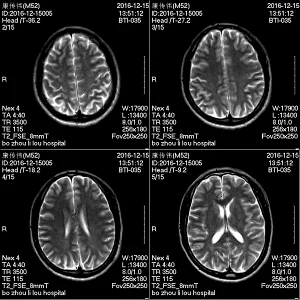 Factory price hospital Medical MRI Scan Magnetic Resonance Imaging System Equipments MRI Scanner Machine