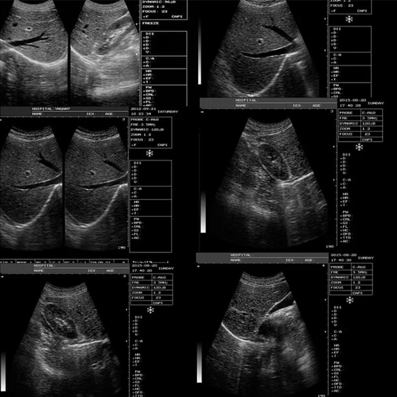 MY-A001A Medical Ultra Sound Machine 10 inch VGA monitor b ultrasound scanner portable ultrasound machine from China