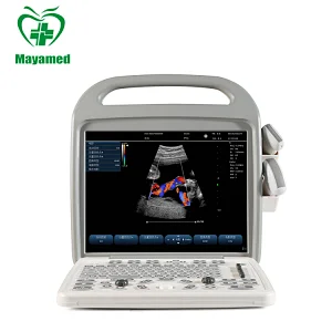 High resolution MAYA medical MY-A033 portable 15 inch 2D Digital Color Doppler Ultrasound System B Ultrasound machine
