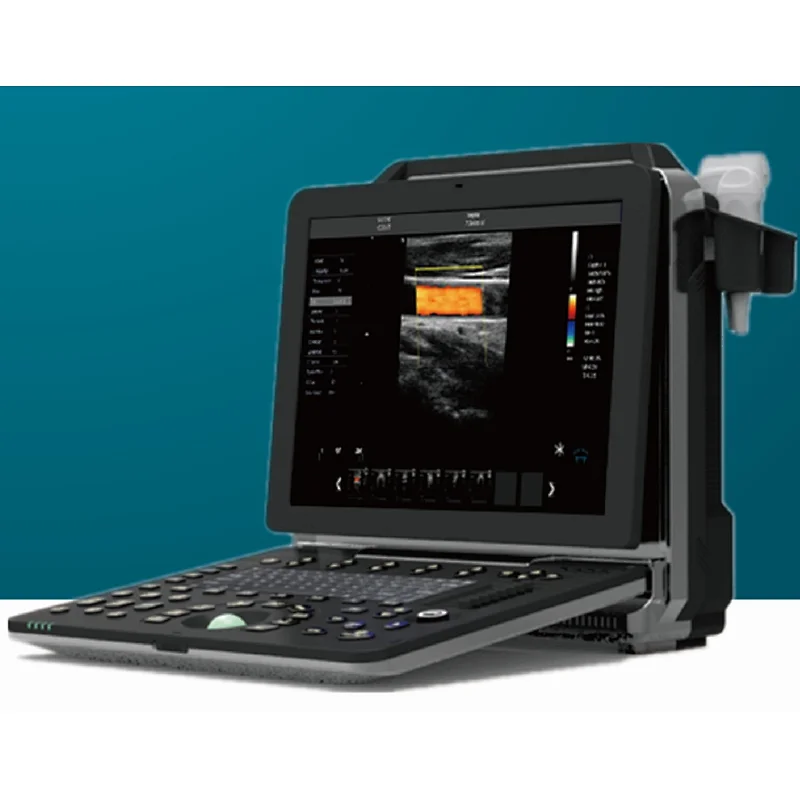 Price ecografo veterinarios eco usb multiparametro veterinarios medical equipment sonoscape dopler portable cheap ultrasound