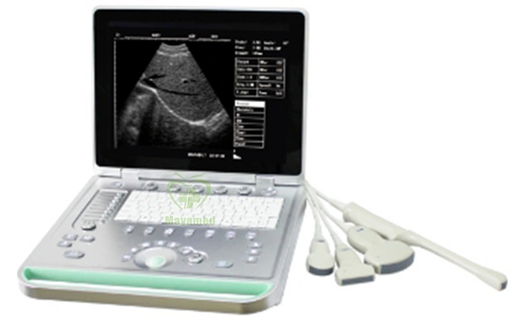 Laptop Ultrasound Scanner.jpg